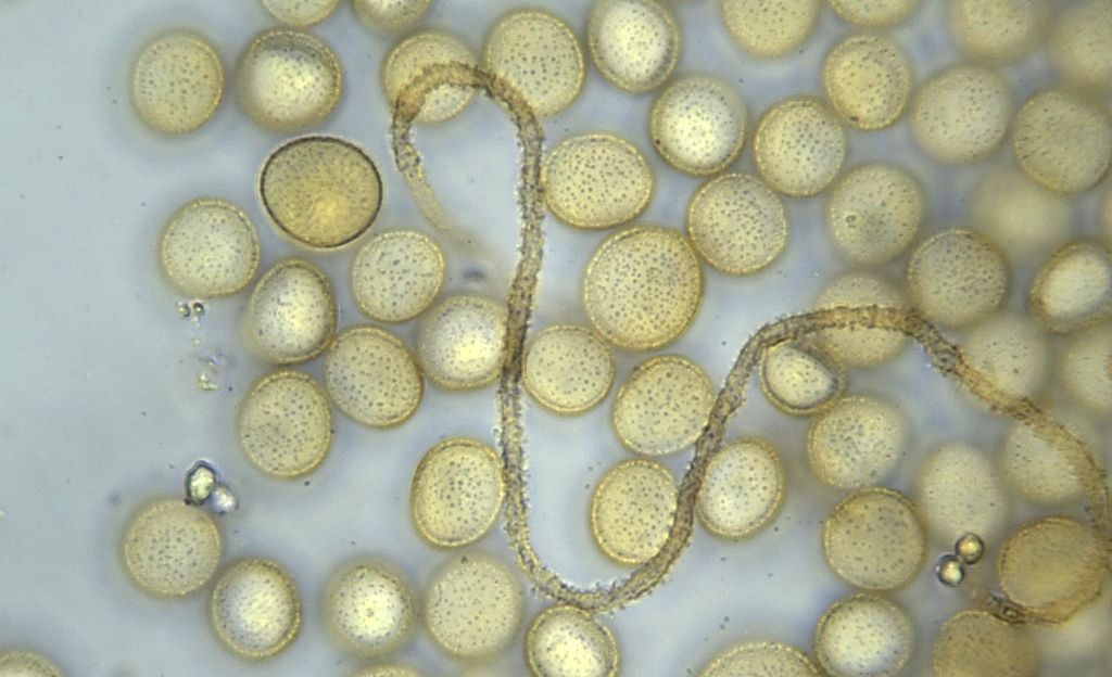 Perichaena depressa?